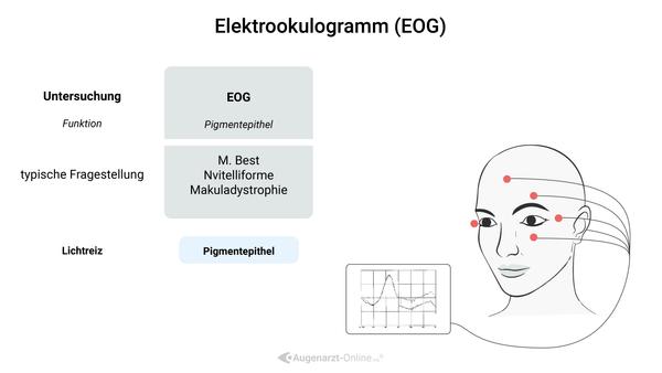 Das Elektrookulogramm (EOG) ist ein diagnostisches Verfahren in der Augenheilkunde, das die elektrische Aktivität der Augenbewegungen und die Funktion des retinalen Pigmentepithels misst. Es wird verwendet, um Anomalien in der Netzhaut zu erkennen, insbesondere bei Erkrankungen wie Retinitis pigmentosa und Best-Krankheit. Die Untersuchung erfolgt durch das Anlegen von Elektroden an der Haut um die Augen und die Registrierung der Spannungsänderungen.