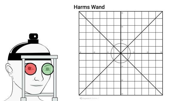 Harms Wand