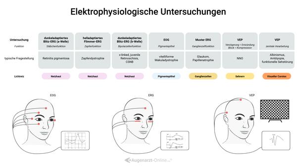 Elektrophysiologische Untersuchungen wie das Elektrookulogramm (EOG), das Elektroretinogramm (ERG) und die Visuell evozierte Potenziale (VEP) sind wichtige diagnostische Verfahren in der Augenheilkunde. Sie dienen zur Beurteilung der Funktion von Netzhaut, Sehnerv und visueller Verarbeitung im Gehirn.