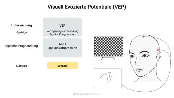 Visuell evozierte Potentiale Untersuchungen