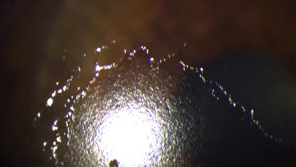 Erosio cornea