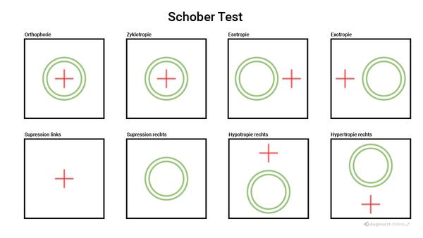 Schober Test