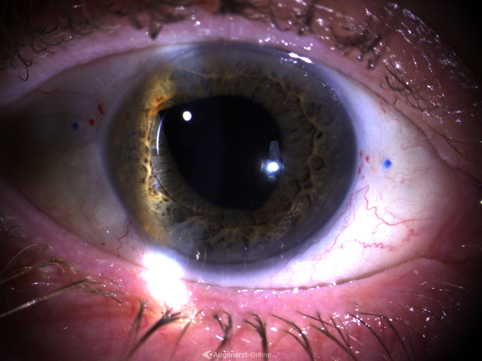 Iris Capture