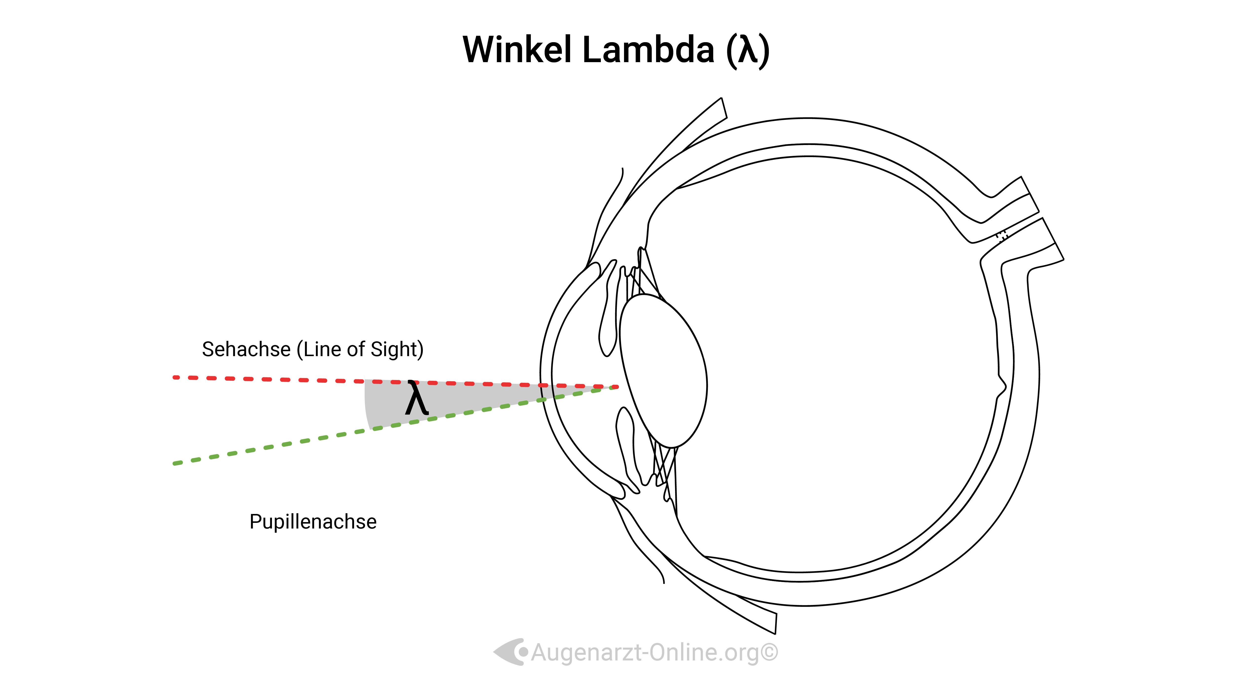 Winkel Lambda