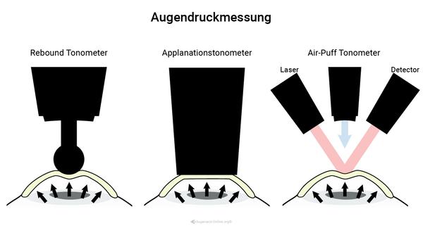 Augendruckmessung