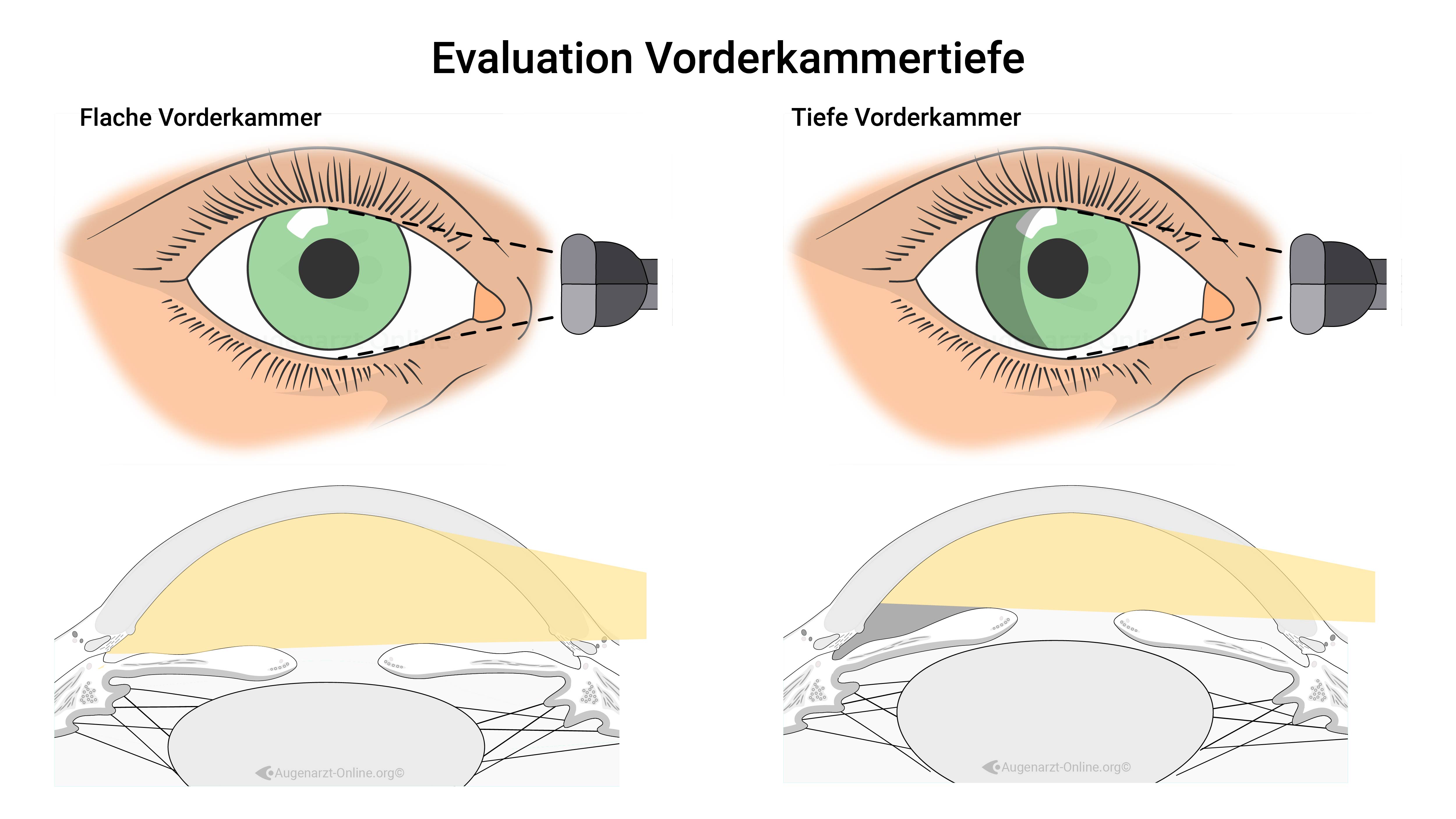 Kammerwinkel Beurteilung