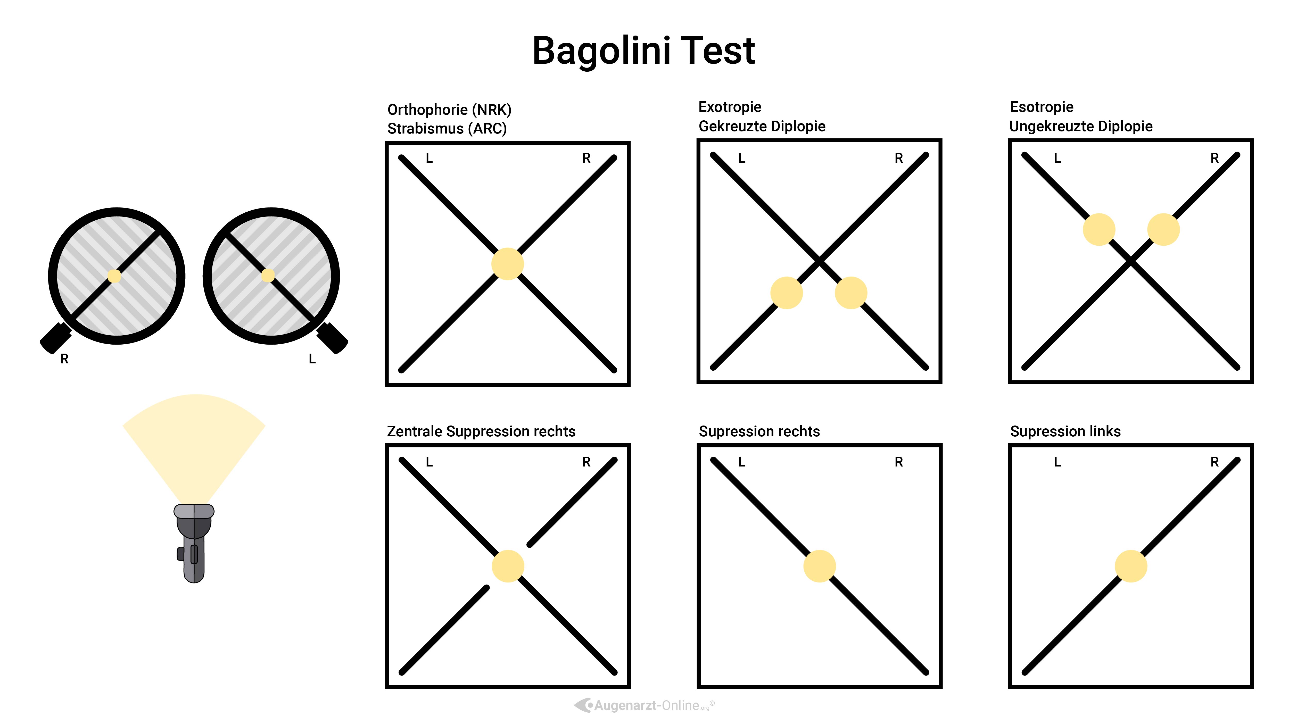 Bagolini Test