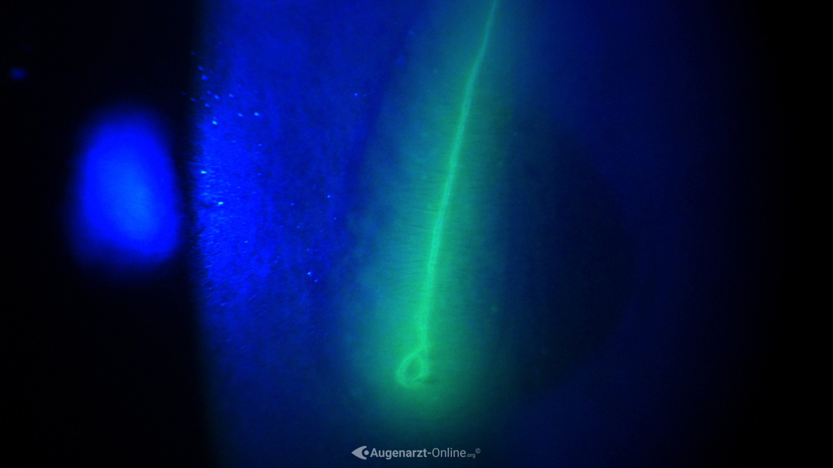 Erosio cornea Pflanzenstiel