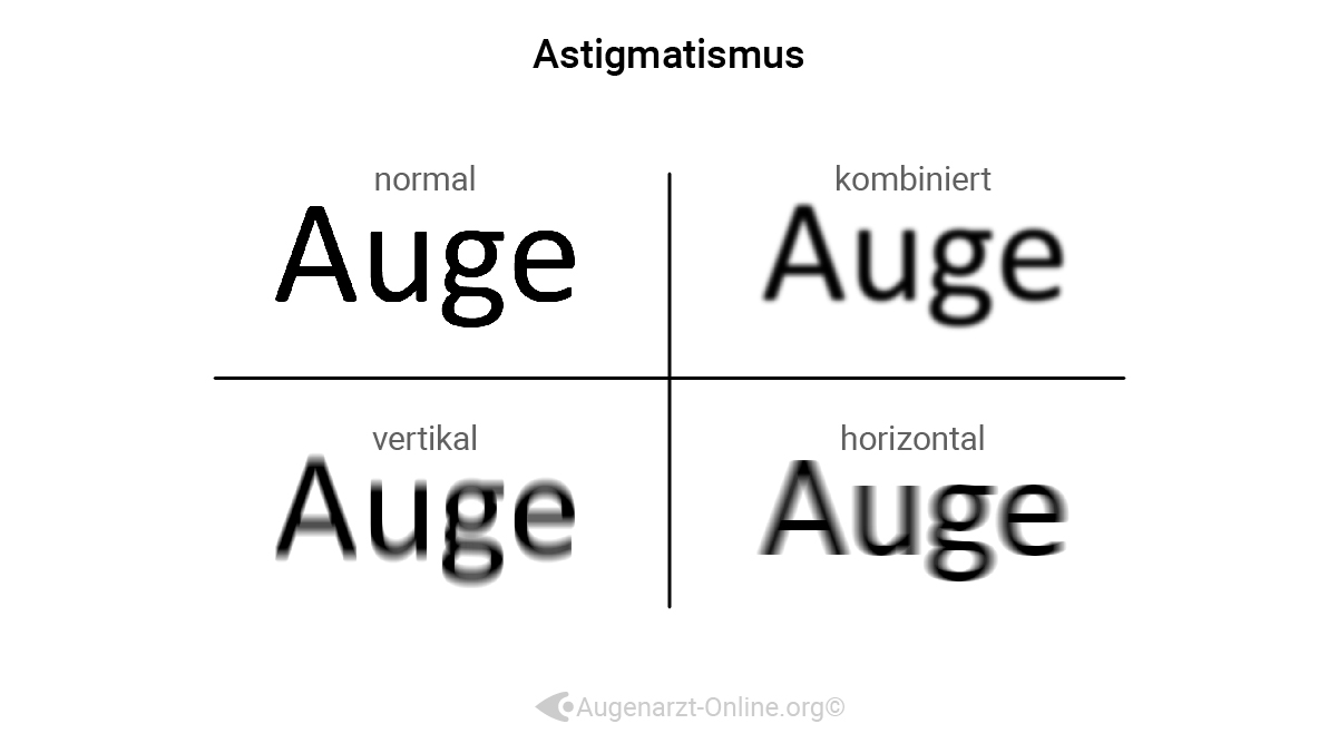 Astigmatismus Seheindruck