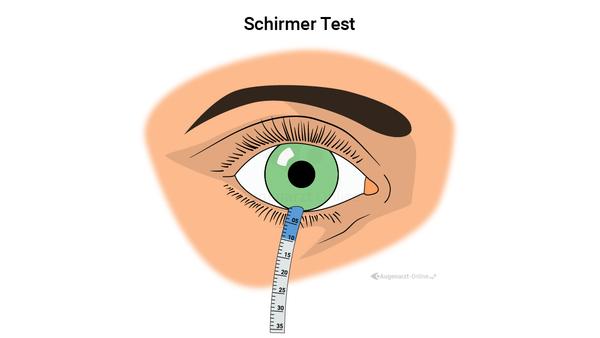 Schirmer Test