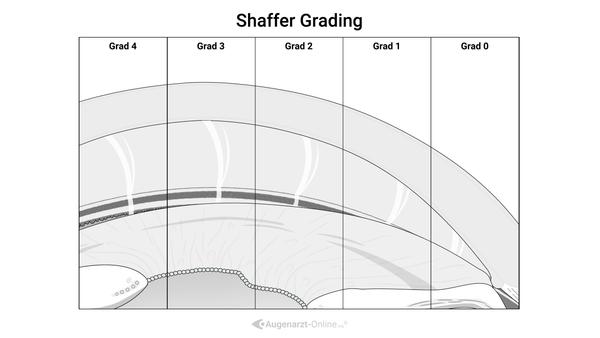 Shaffer Grading