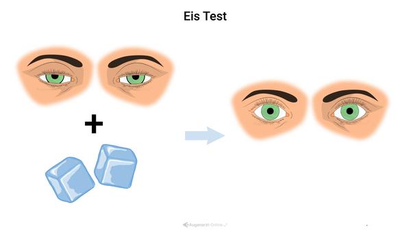 Eis Test