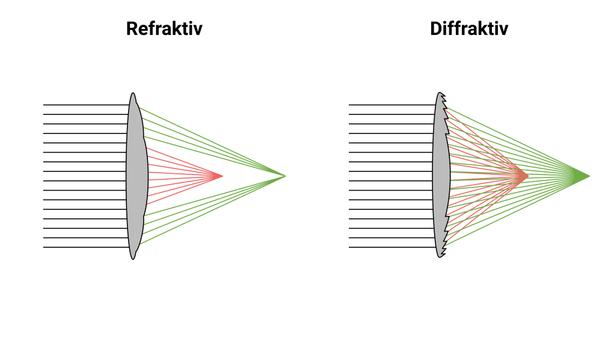 Multifokallinsen: Funktionsprinzip refraktive und diffraktive Linsen
