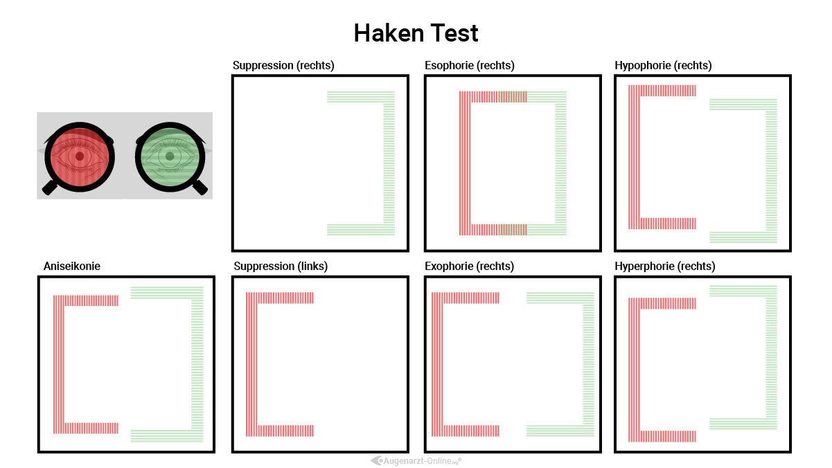 Hakentest
