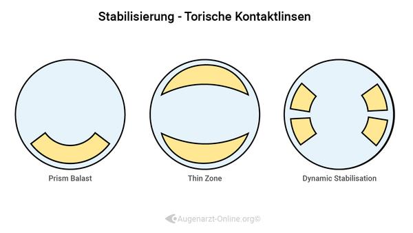 Torische Kontaktlinsen Designs