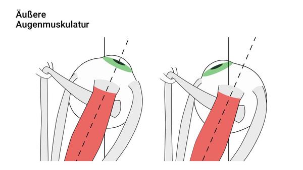 Augenmuskel (Musculus rectus superior)